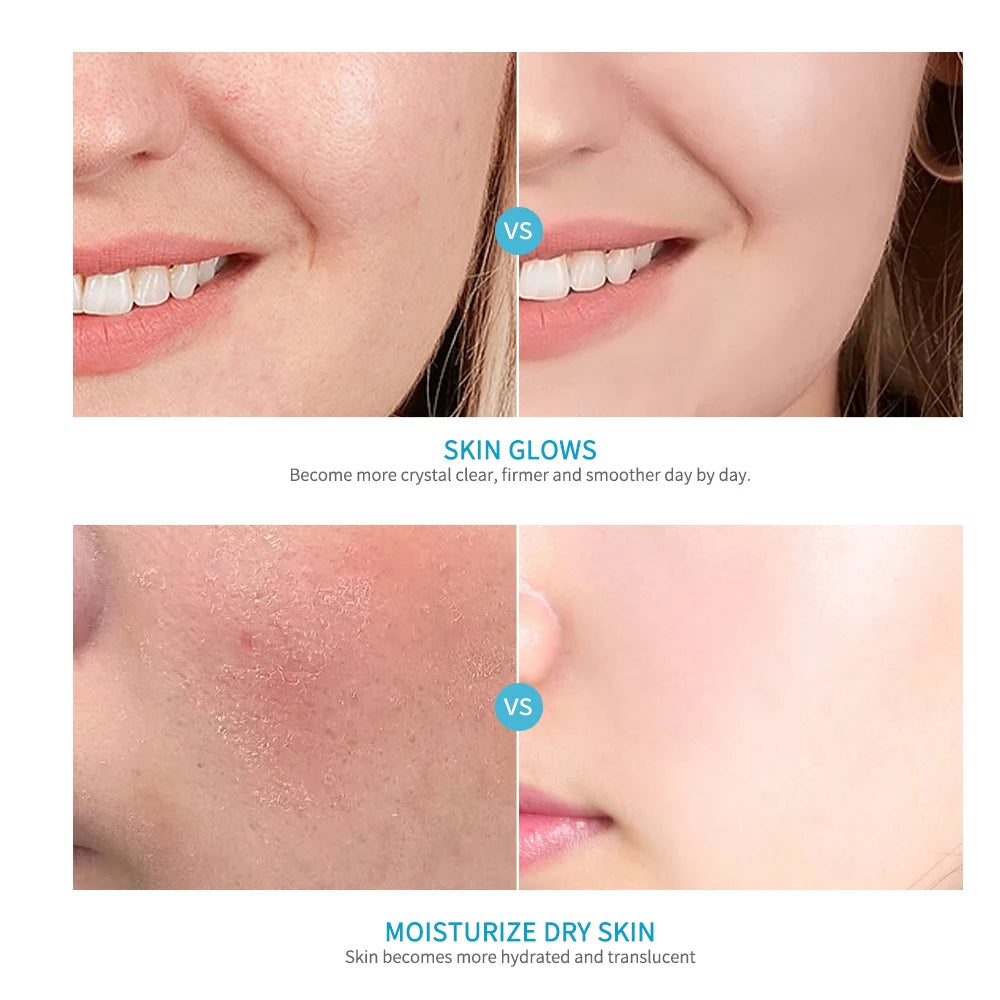 Ibcccndc 5 Piece Skincare Set Hydrate Brighten Firm