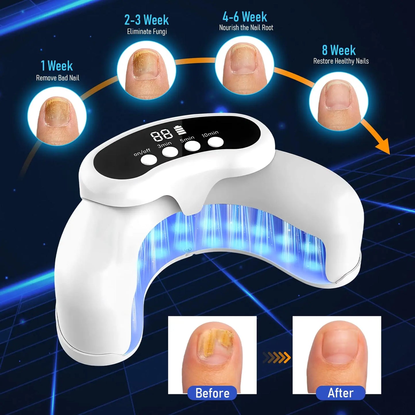 45W Nail Fungus Treatment Device 30 LEDs 470nm 905nmNail Fungus Cleaning for Damaged Discolored Thick Toenails&Fingernails