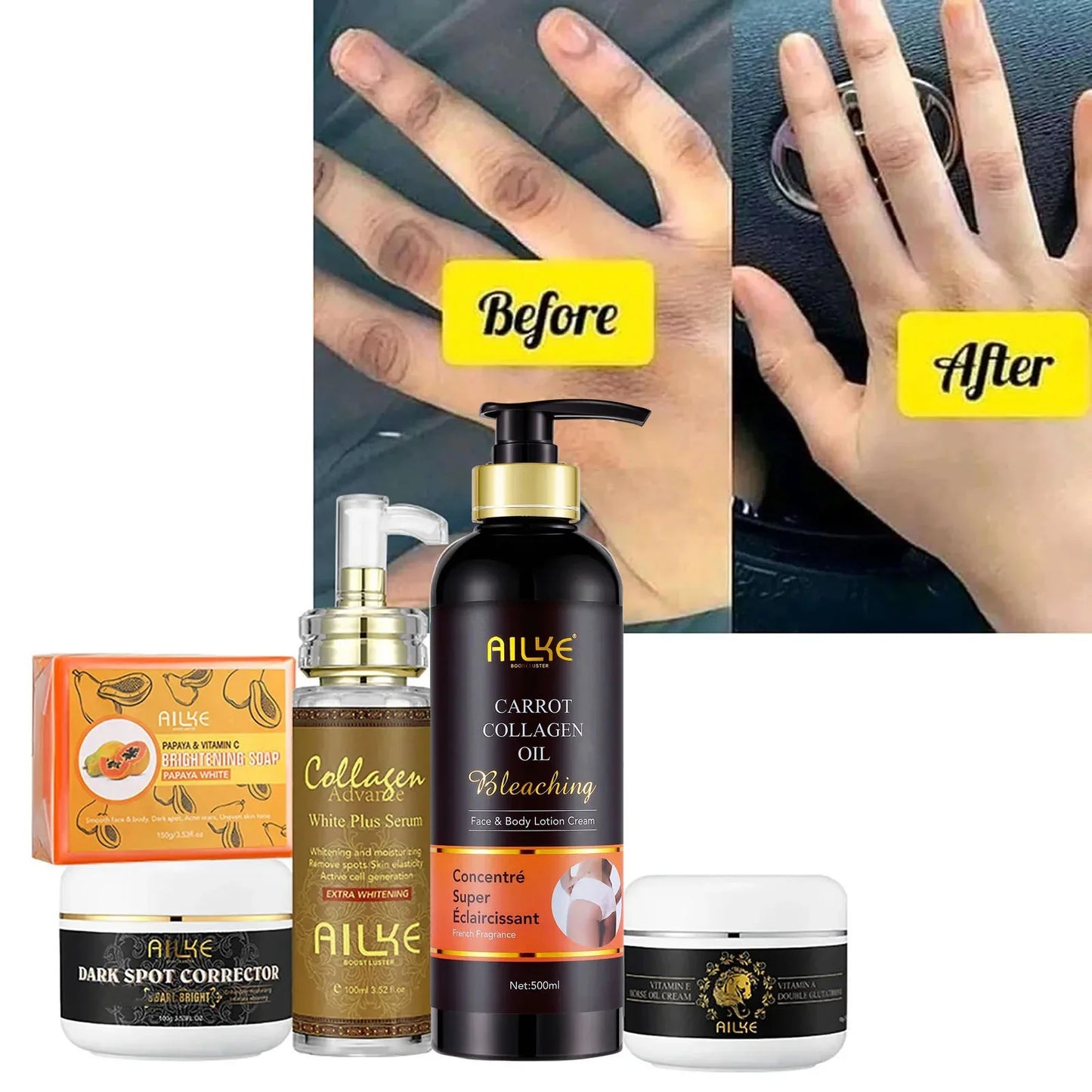 AILKE Whitening Skin Care Set, With Nicotinamide, Glutathione, Moisturizing, Even Skin Tone, Remove Dark Spot, Freckle, Melanin